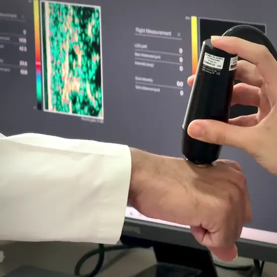 The Cortex DermaLab ultrasound probe on the back of a hand while the screen shows a cross-sectional ultrasound image of the skin